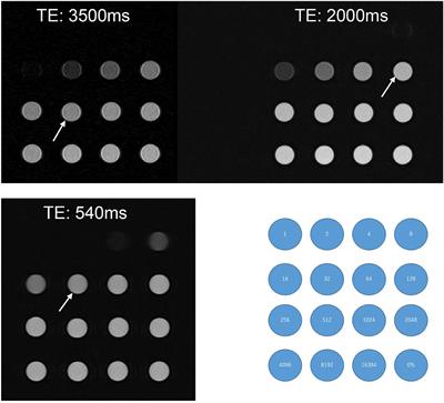 17O-labeled water distribution in the human inner ear: Insights into lymphatic dynamics and vestibular function